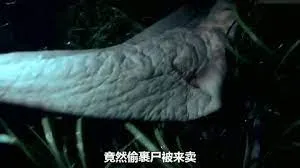 性昏迷
